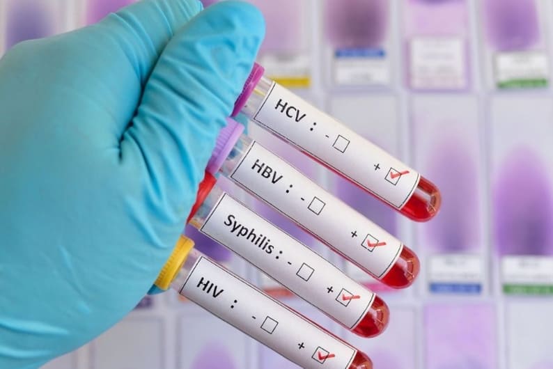 Paquete de detección de ITS